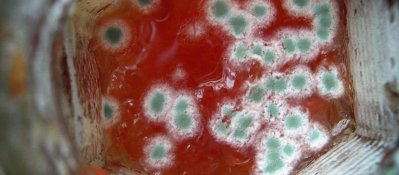 Τι είναι η λιστερίωση και ποια τα συμπτώματα της νόσου;